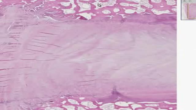 Histology of Intervertebral Disk