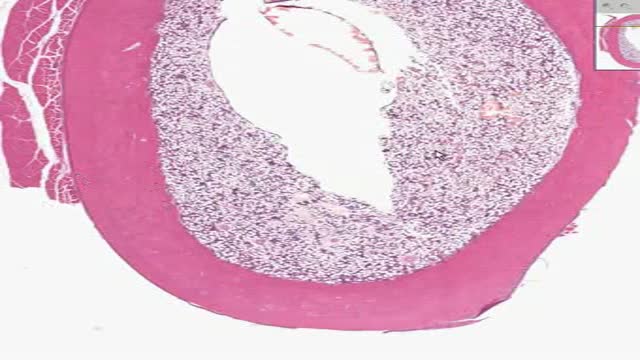 Histology of Dense Bone