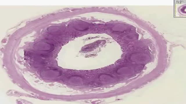 Histology of Appendix