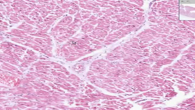 Histology of Heart Endocardium Pericardium Epicardium