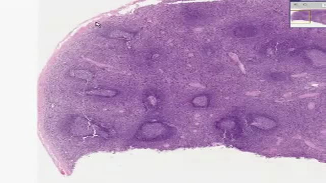 ⁣Histology of Spleen