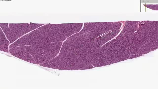 Histology of Sublingual Gland