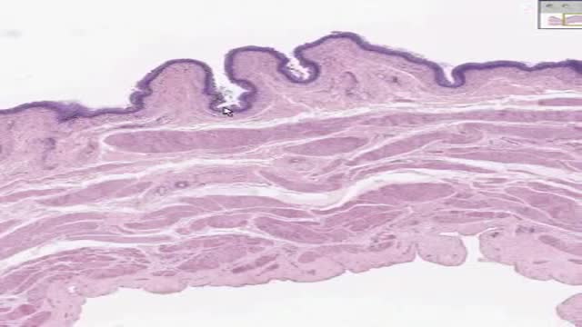 ⁣Histology of Urinary Bladder