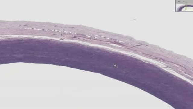 ⁣Histology of Aorta Elastic Stain
