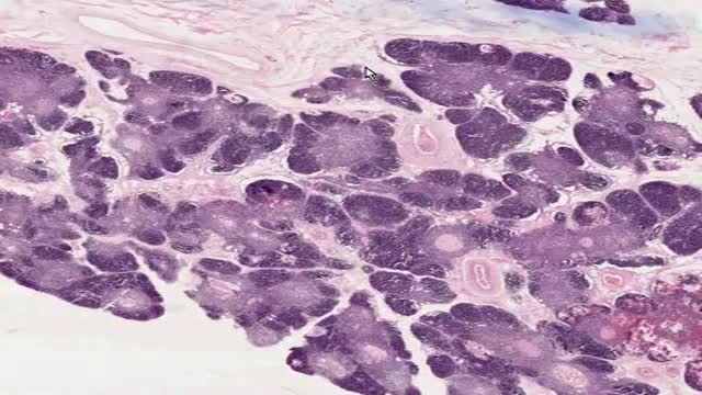 Histology of Thymus