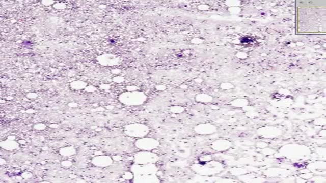 Histology of Bone Marrow Smear