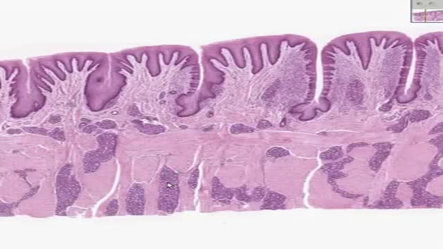 ⁣Histology of Tongue Folliate Papilla