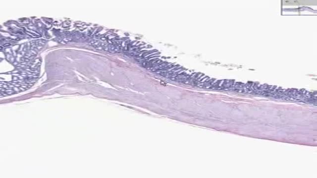 Histology of GastroDuodenal Junction