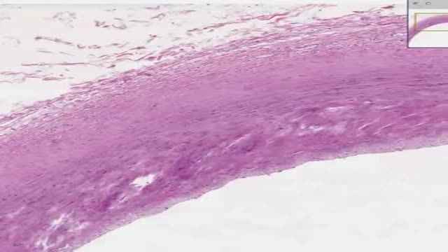 Histology of Large Artery