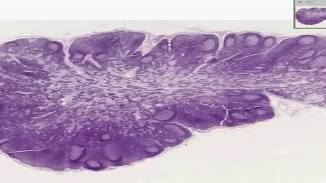 Histology of Lymph Node