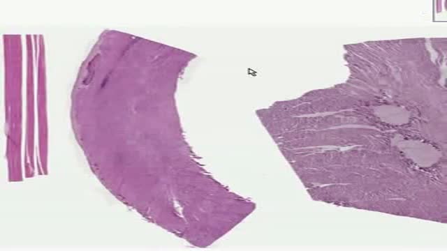 Histology of Mucles Skeletal Smooth Cardiac