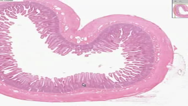 ⁣Histology of Small Intestine Jejunum