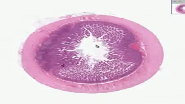 ⁣Histology of Small Intestine Illeum