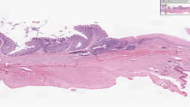 Histology of Rectoanal Junction