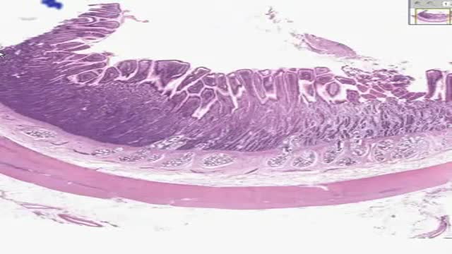 ⁣Histology of Small Intestine Duodenum