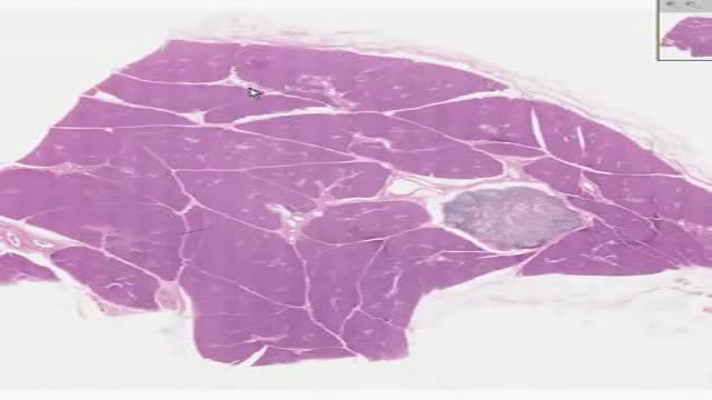 Histology of Parotid Gland