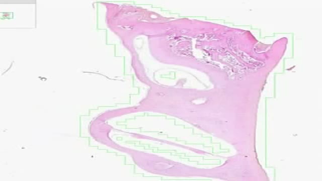 Histology of Inner Ear 2