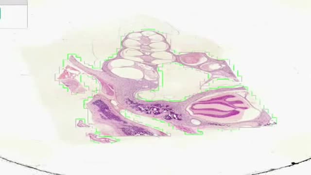 Histology of Inner Ear 1