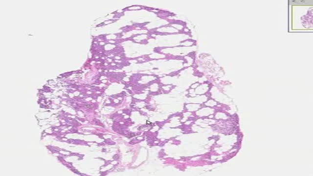 ⁣Histology of Parathyroid