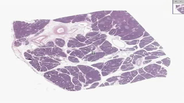 Histology of Pancreas