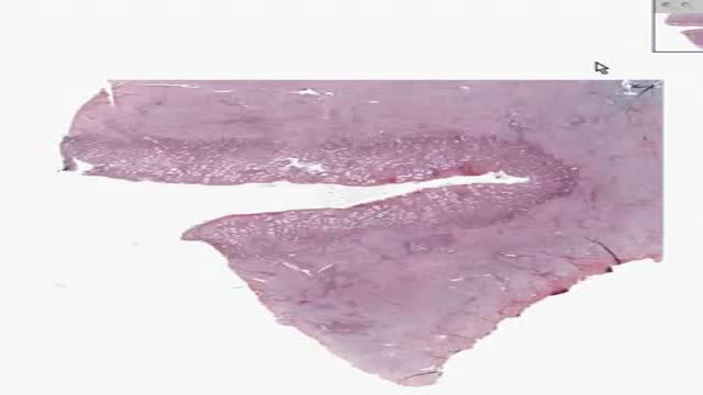 Histology of Secretory Endometrium