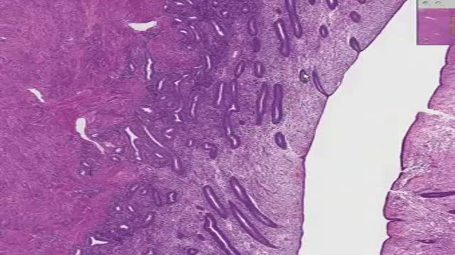 Histology of Proliferative Endometrium