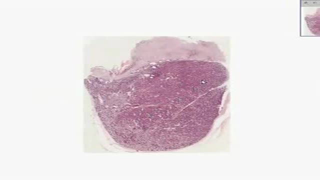 Histology of Pituitary