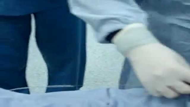 laser liposuction Video