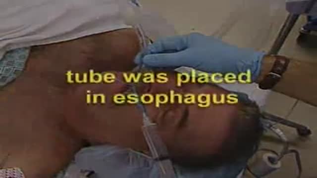 ⁣Oesophageal Intubation