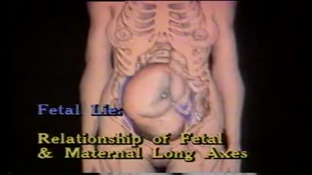 ⁣Fetal lie and presentations