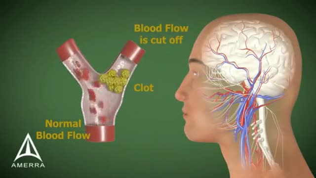 Stroke Animation 3D