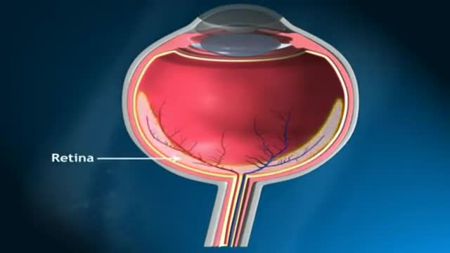 ⁣How does Glaucoma Develop