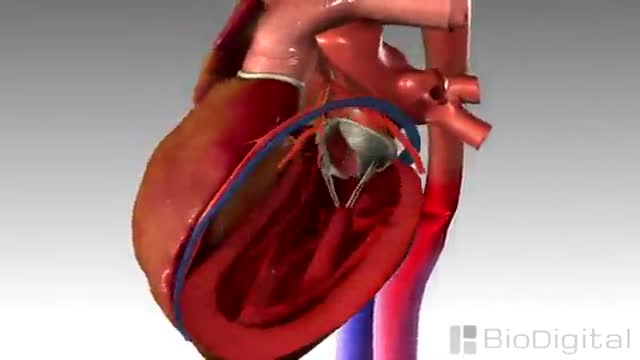 Congestive Heart Failure 3D Animation