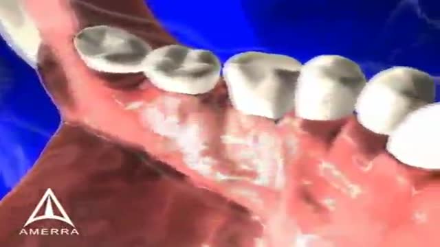 Tooth Anatomy 3D Medical Animation