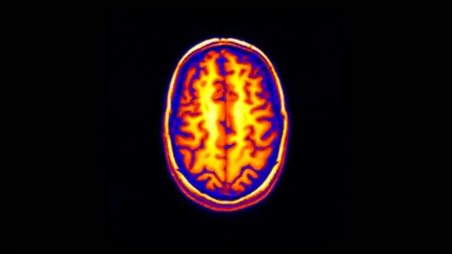 3D MRI of Human Brain