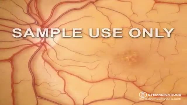 ⁣Complete Eye Exam Importance 3D Animation