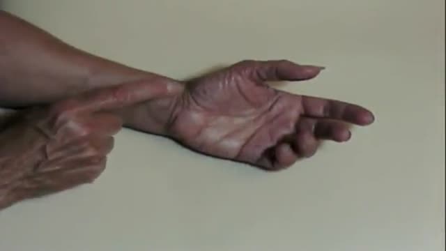 Carpal Tunnel Syndrome Self Test