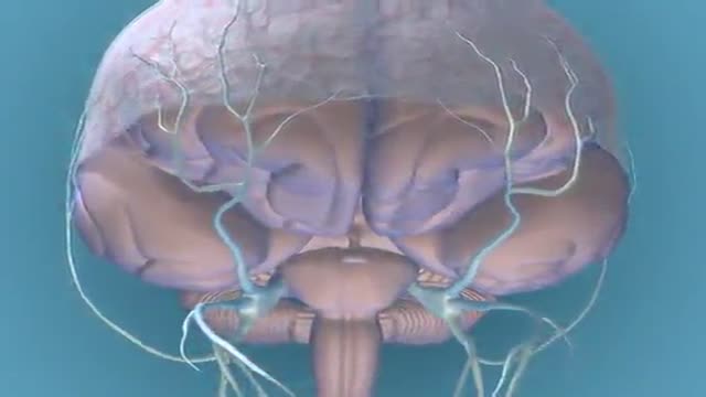 ⁣Migraine Pathophysiology 3D Animation