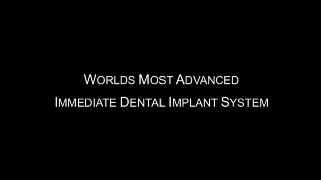 ⁣Amazing immediate implant uppermolar in 20 seconds