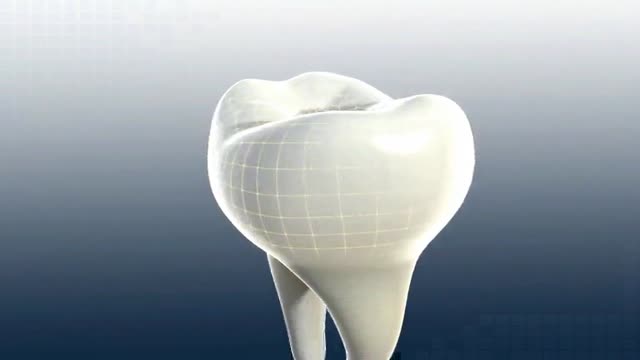 Dental 3D Animation