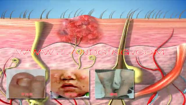 ⁣Dermatology Animation