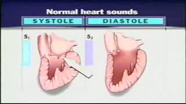 ⁣Review of heart sounds