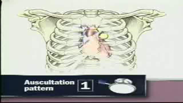 Auscultation of the heart