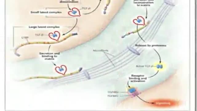 Marfan Syndrome