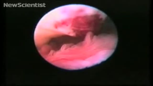 Human ovulation captured on film