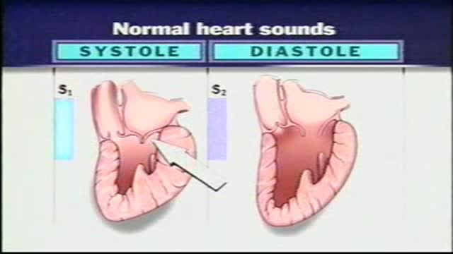 ⁣Normal Heart Sounds