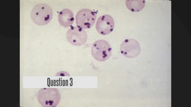 Medical hints (hematology question)