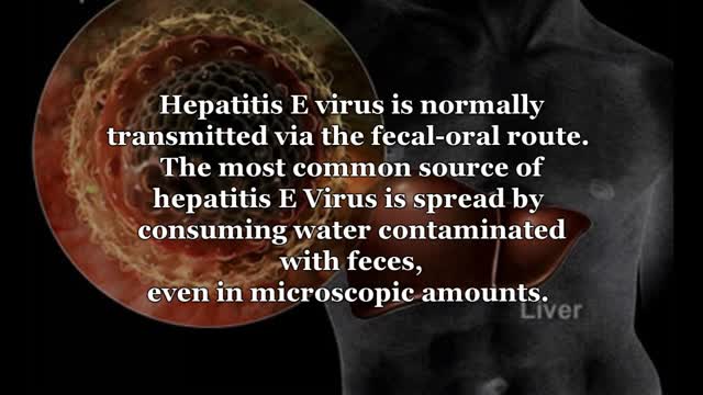 ⁣Hepatitis E