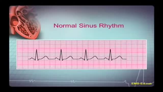 ⁣EKG Interpretation Part 1