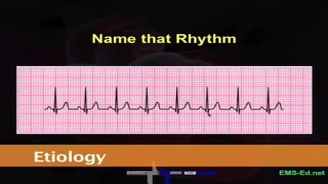 ECG part 2